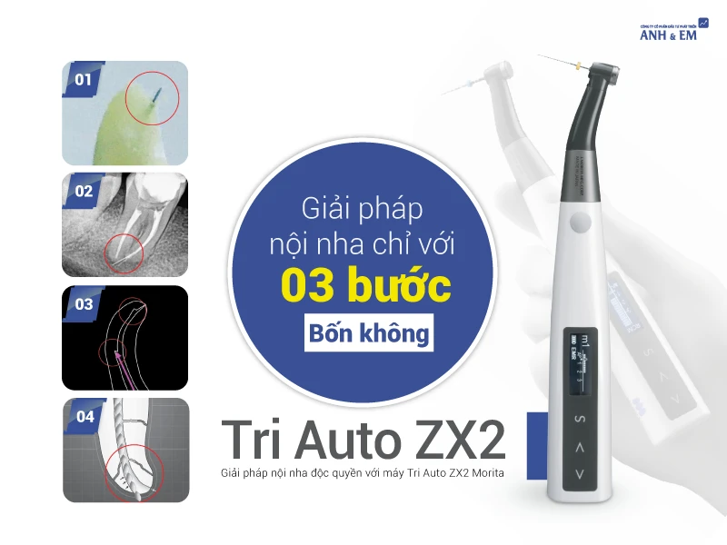 noi-nha-3-buoc-4-khong