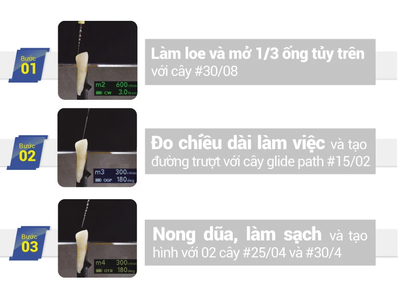 Ba-buoc-bon-khong-noi-nha-voi-may-TRZX2-morita