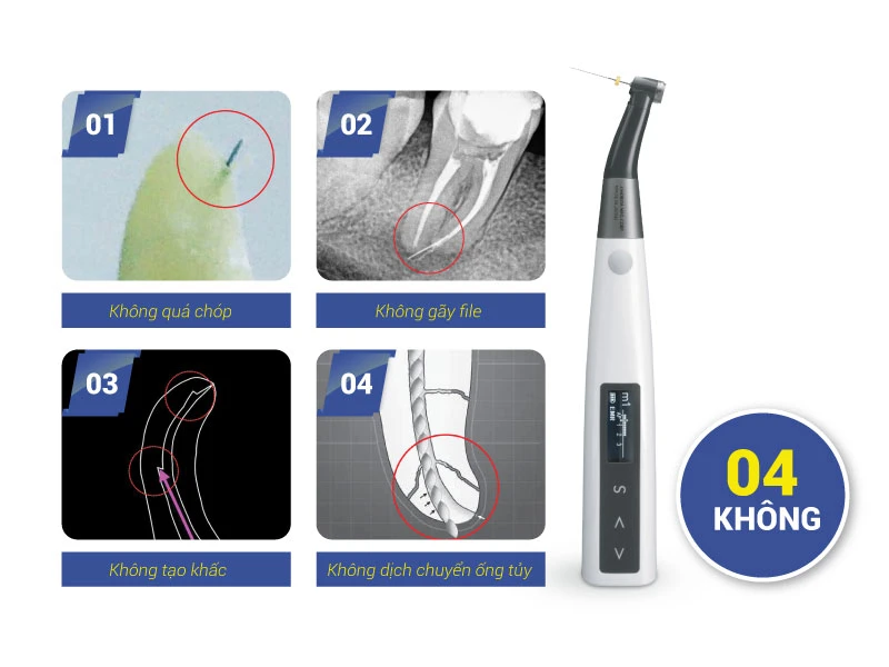 Ba-buoc-Bon-khong-voi-may-noi-nha-Morita