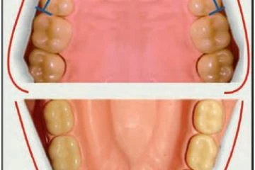 PHÂN TÍCH WAYNE A. BOLTON