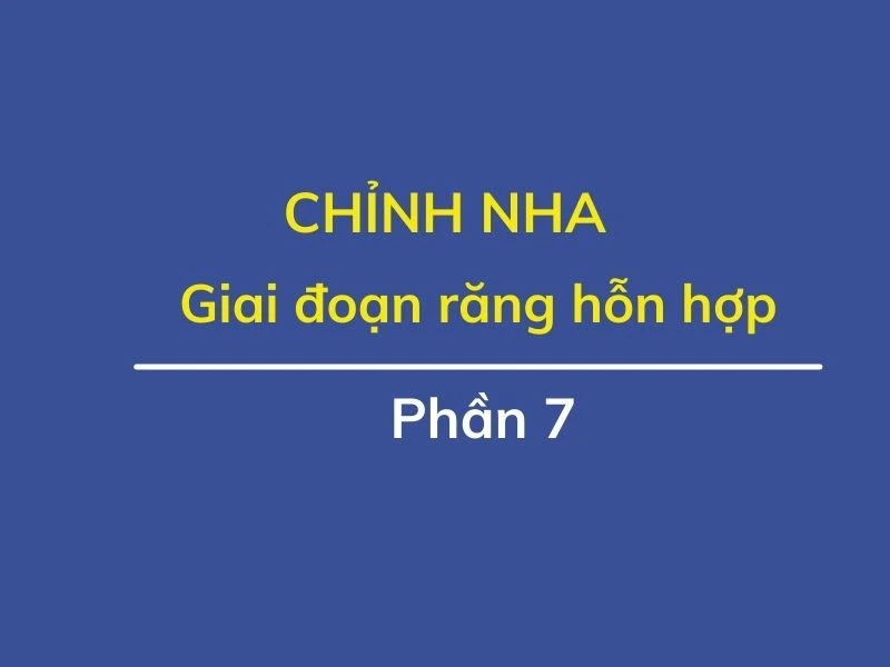 Chỉnh nha ( phần 7): giai đoạn răng hỗn hợp