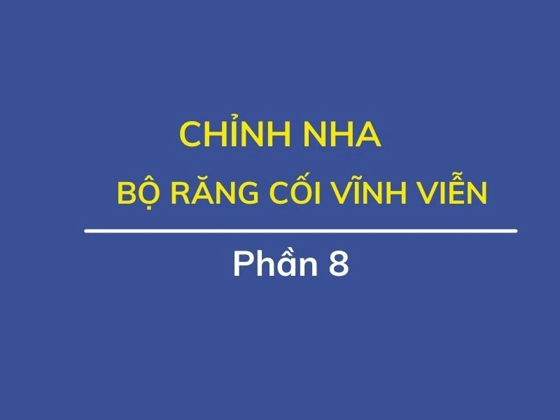 Chỉnh nha ( phần 8): bộ răng cối vĩnh viễn