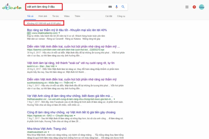 Quảng cáo nha khoa Nacera