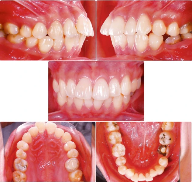 anh-chup-trong-mieng-truoc-khi-dieu-tri