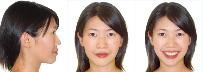 anh-chup-sau-dieu-tri