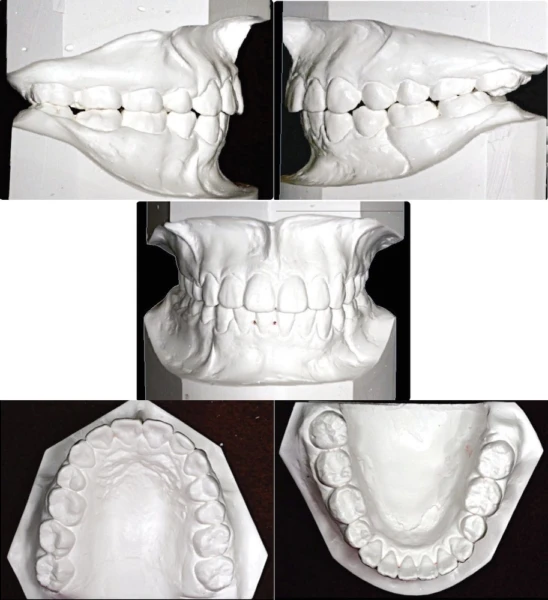 mau-nghien-cuu-sau-dieu-tri