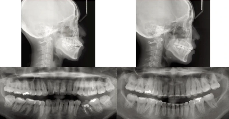 phim-xquang-toan-canh