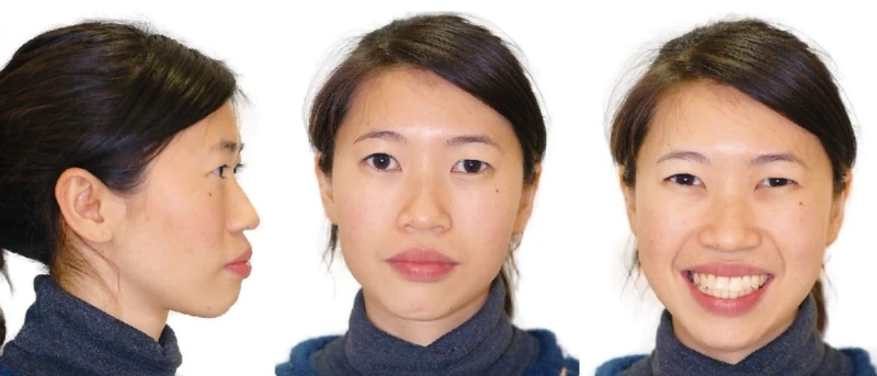 anh-chup-truoc-khi-dieu-tri