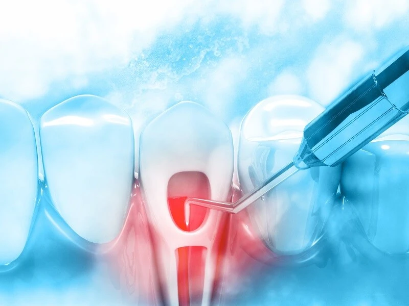 laser-trong-noi-nha-phan-ii-2