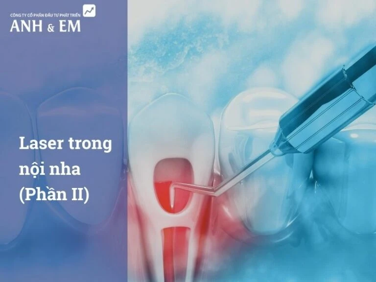 laser-trong-noi-nha-phan-ii