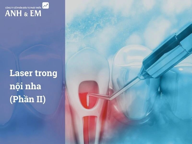 laser-trong-noi-nha-phan-ii