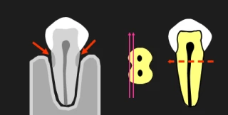hướng tia x-quang