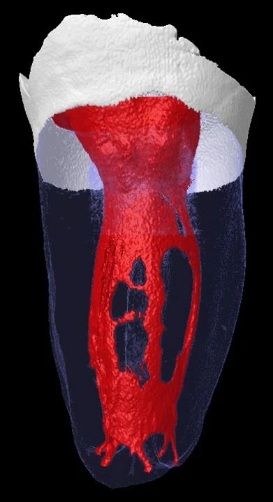 HỆ THỐNG ỐNG TỦY