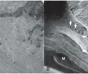 Hệ thống ống tủy - 156 file
