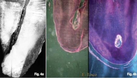 Quyết định chiều dài làm việc và cách xác định điểm chóp cuối cùng 2