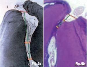 Quyết định chiều dài làm việc và cách xác định điểm chóp cuối cùng  điểm thắt chóp  CDJ