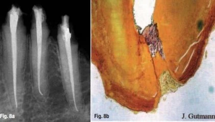 các ít mô cần được chữa