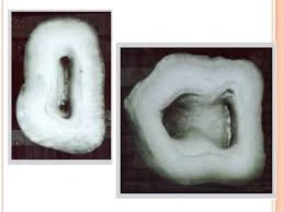 Các quy luật mở tủy trong điều trị nội nha QUY LUẬT TRUNG TÂM