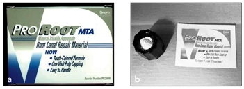 Các Tai Biến Khi Tạo Hình Ống Tủy