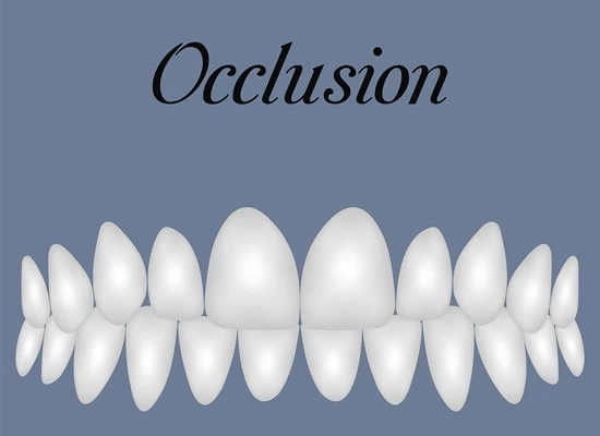 Giới thiệu chỉnh nha các mẫu hàm thường gặp