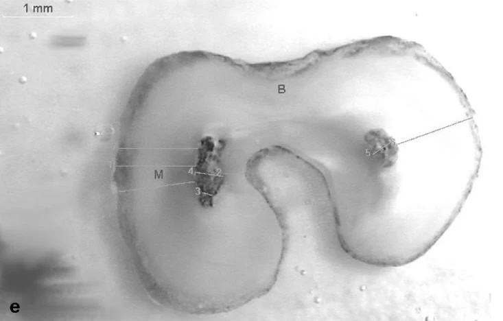 Ống tủy hình chữ C 4