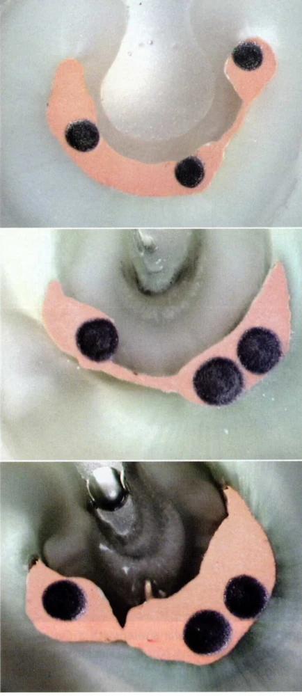 Ống tủy hình chữ C ÔT