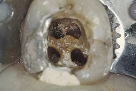 trưa mở hết trần tủy