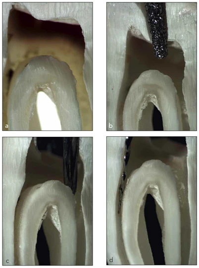 chỉnh sửa lối vào phân kì