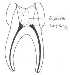 LẤY BUỒNG TỦY trạm tám
