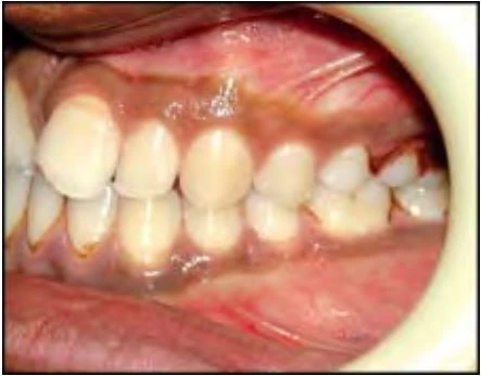 phan-loại-sai-khop-can