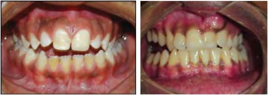 phan-loại-sai-khop-can