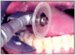 đĩa kim cương đục lỗ