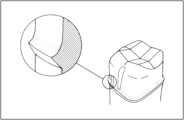 duong-bo-dai-cui-rang