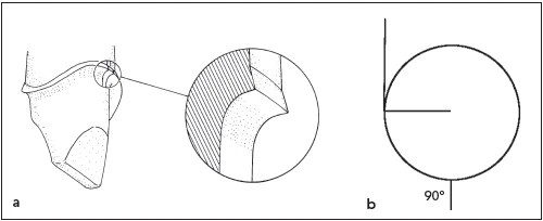 duong-bo-cong-sau-trong-cui-rang