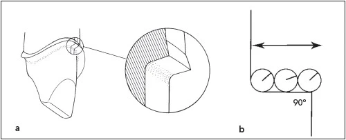 bo-vai-cong-tren-hop-su