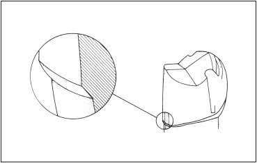 CÁC NGUYÊN TẮC MÀI CÙI RĂNG 