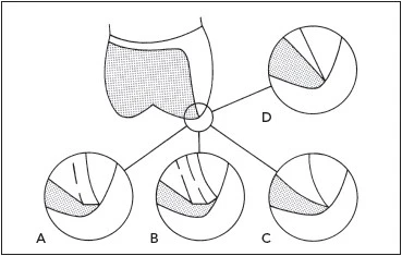 duong-tat-nhai-ngoai-cui-rang