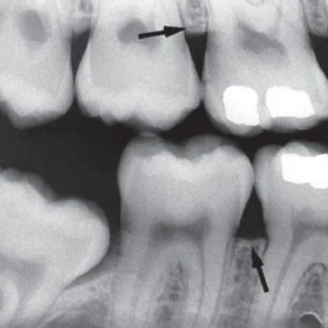 X-ray ( phần 1) - 233 file