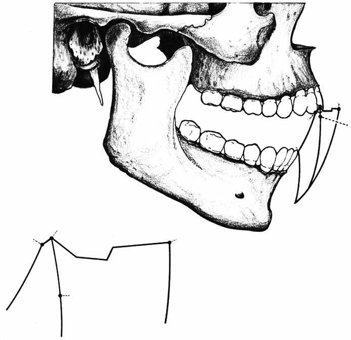 VẬN ĐỘNG BIÊN CỦA ĐIỂM RĂNG CỬA GHI TRÊN MẶT PHẲNG DỌC GIỮA(SƠ ĐỒ POSSELT)