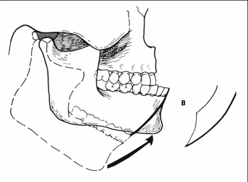 từ điểm há ra nếu hàm không bằng hàm trước
