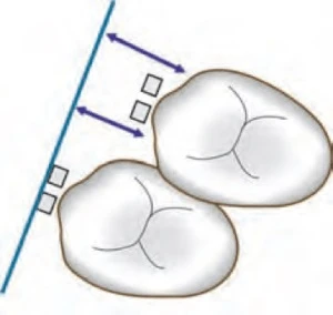 Hai điểm tiếp xúc khí cụ