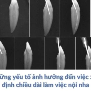 chiều dài làm việc