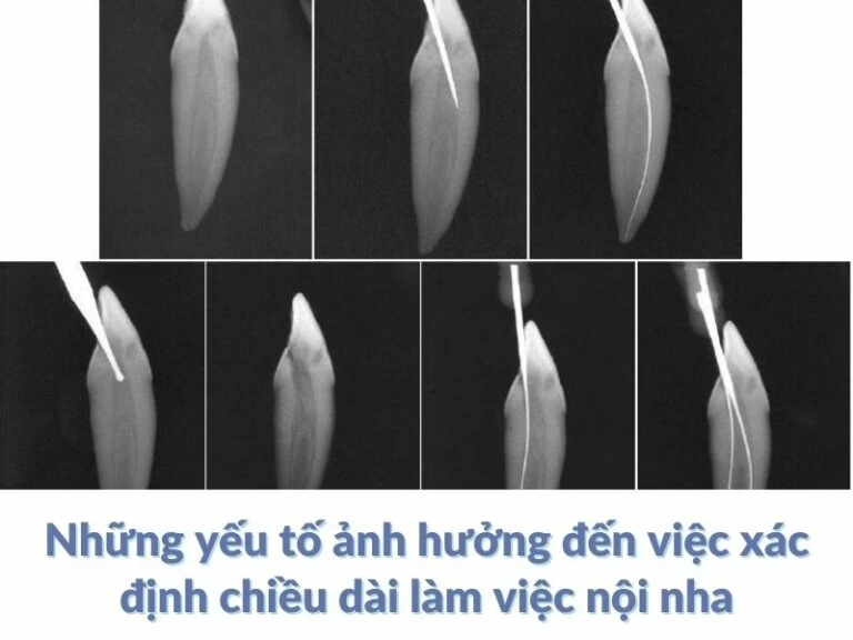 chiều dài làm việc