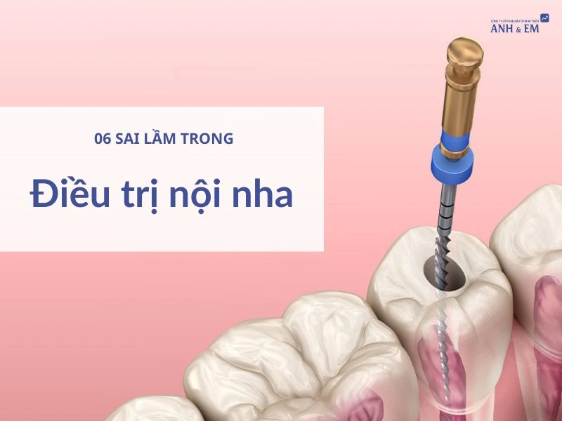 06-sai-lam-trong-dieu-tri-noi-nha