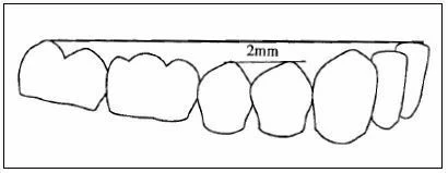 su-dich-chuyen-rang-trong-chinh-nha
