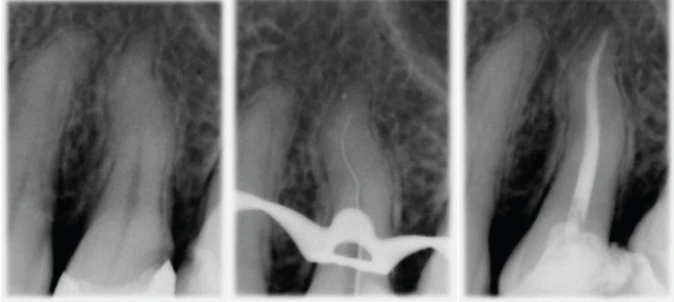 4-ca-noi-nha-lan-sang
