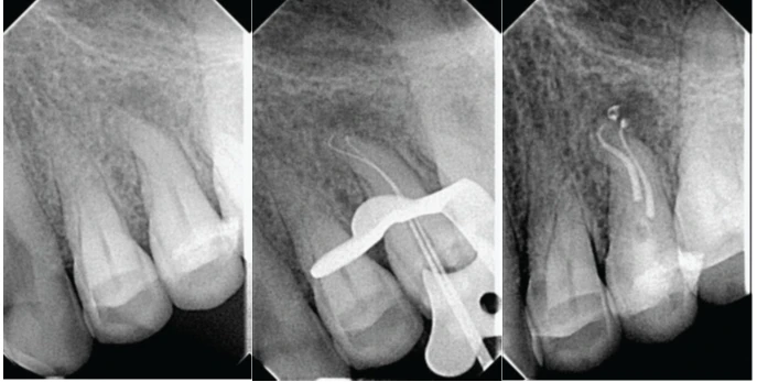 4-ca-noi-nha-lan-sang