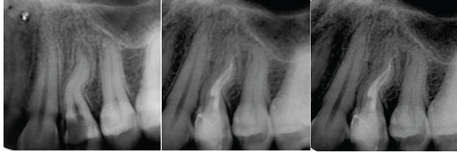 4-ca-noi-nha-lan-sang