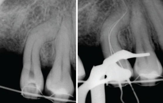 4-ca-noi-nha-lan-sang