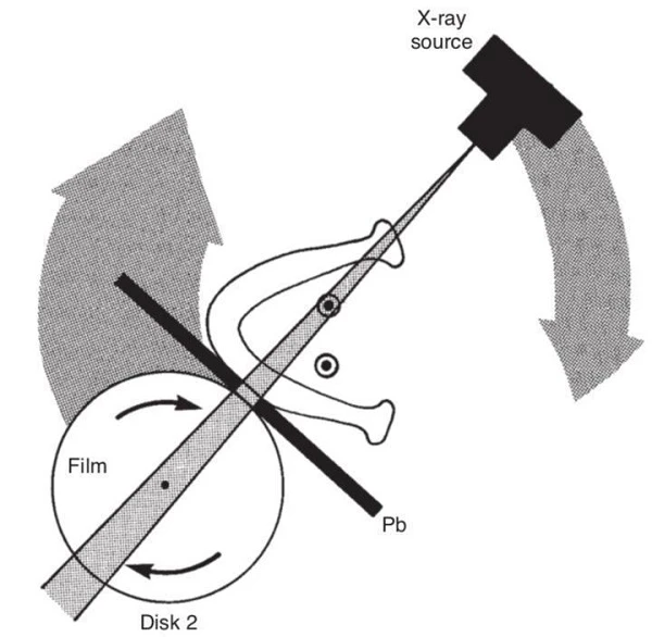 Hình 4. Di chuyển của phim và nguồn tia X quanh một tâm xoay thay đổi. Pb, ống chuẩn trực chì.